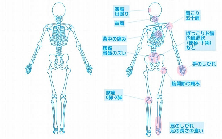 足 しびれ 腰痛 の