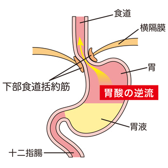 のどの病気 扁桃炎 咽頭炎 西宮市や芦屋市のくらかわ整形外科 耳鼻咽喉科